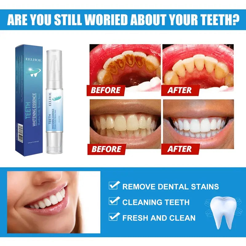 Tooth Cleaning Pen for Yellow Teeth Removal and Care