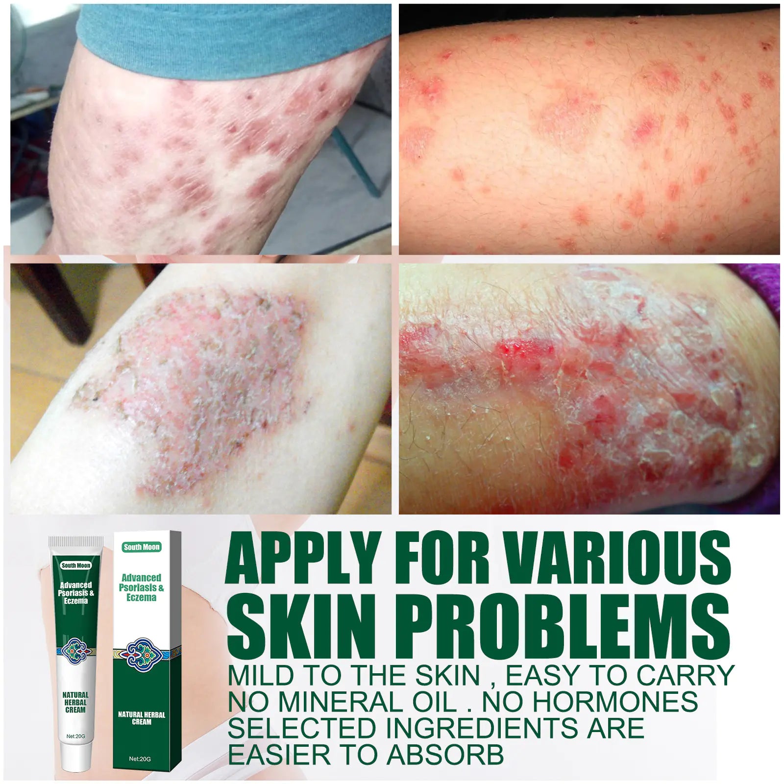 South Moon Herbal Cream for Moisturizing and Itch Relief