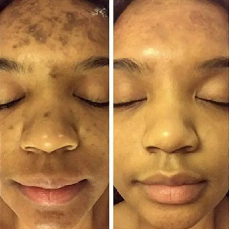 BrightGlow Turmeric Radiance Serum - Unleash Your Skin's Natural Glow